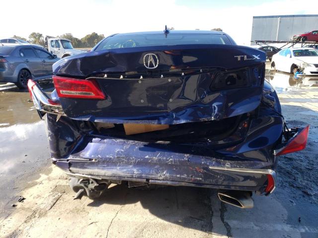 19UUB2F44LA004019 Acura Tlx Technology