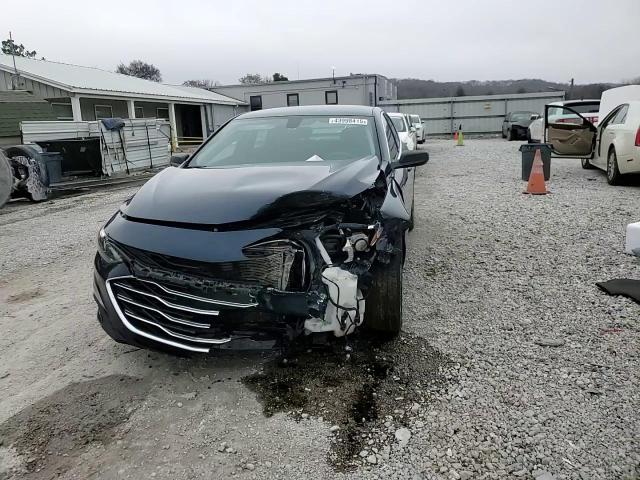 2022 Chevrolet Malibu - Image 10
