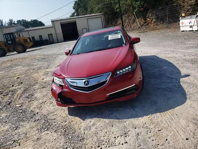 19UUB1F51HA005039 2017 Acura Tlx Tech