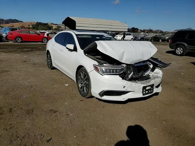 19UUB3F33JA002904 2018 Acura Tlx