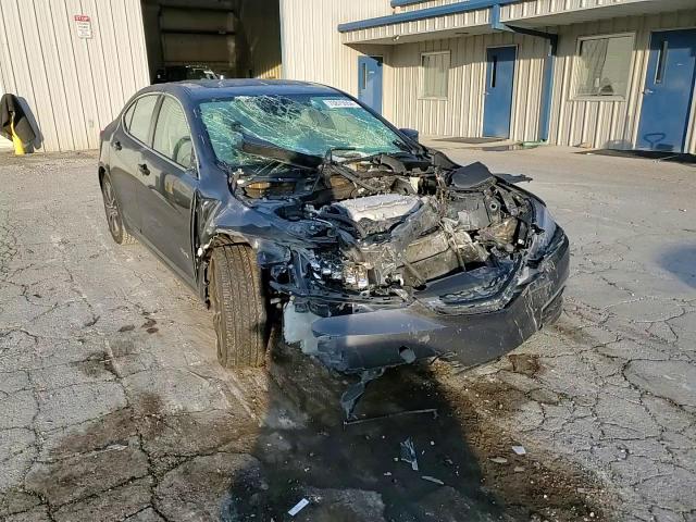 19UUB2F51FA014942 2015 Acura Tlx Tech