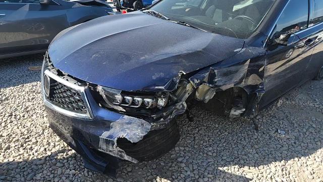 2019 Acura Tlx Technology VIN: 19UUB1F50KA004522 Lot: 80091035