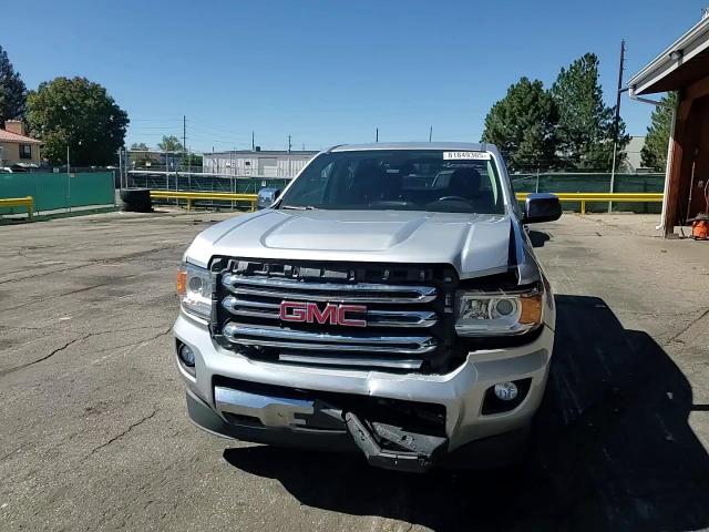 2015 GMC Canyon Slt VIN: 1GTG6CE35F1191497 Lot: 81849305