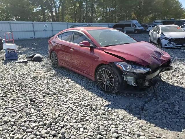 2017 Hyundai Elantra - Image 11