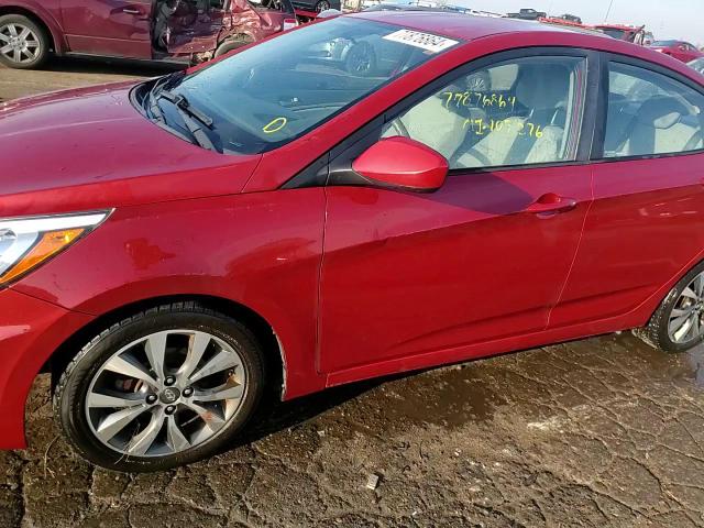 2017 Hyundai Accent Se VIN: KMHCT4AE5HU374965 Lot: 77876864