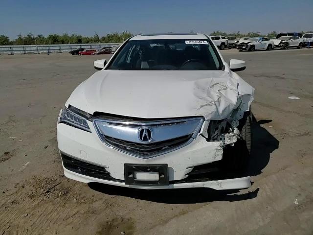 2016 Acura Tlx VIN: 19UUB1F31GA005054 Lot: 76049424