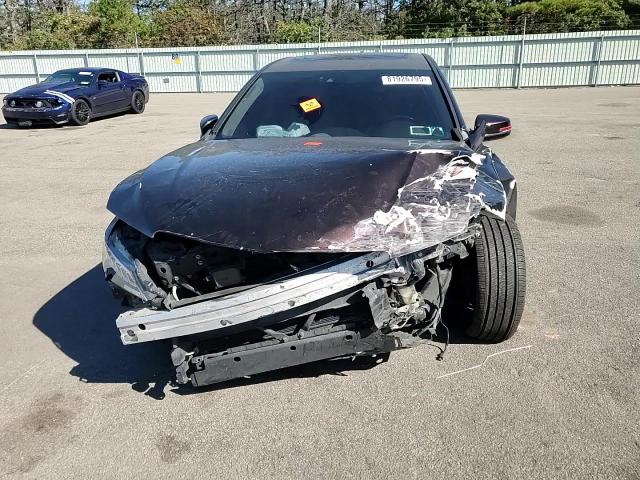 2016 Acura Tlx Advance VIN: 19UUB3F71GA004145 Lot: 81926795