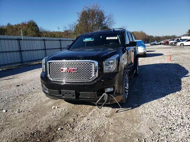 2017 GMC Yukon Denali VIN: 1GKS2CKJ9HR379862 Lot: 79574714