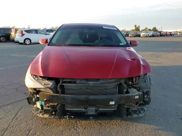 2021 Hyundai Elantra Limited VIN: KMHLP4AG2MU152173 Lot: 81429794