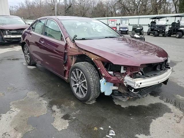 2016 Acura Tlx VIN: 19UUB2F30GA005049 Lot: 94450385