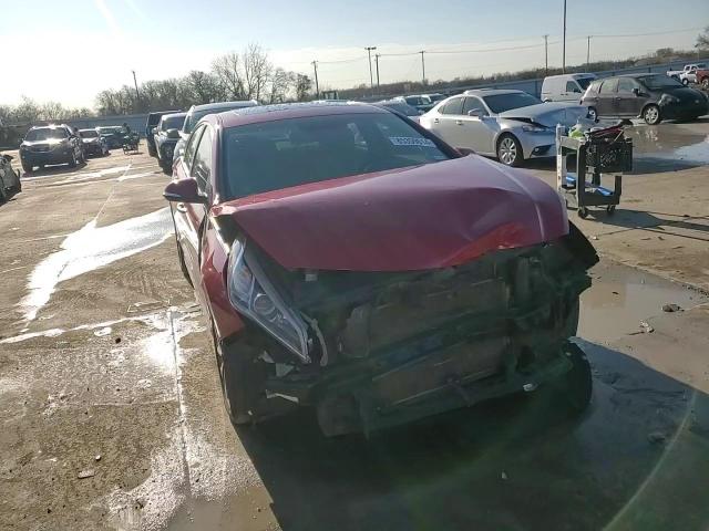 2017 Hyundai Sonata - Image 10