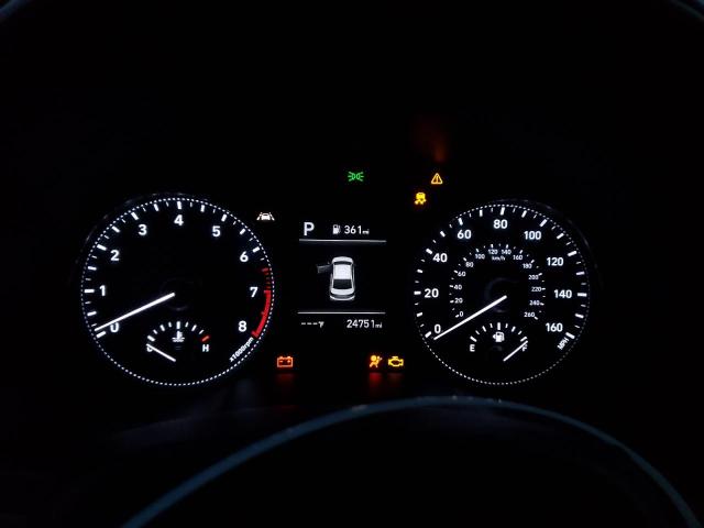 KMHD84LF2LU075647 Hyundai ELANTRA SEL