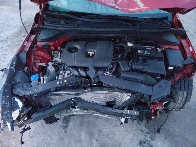 KMHD84LF2LU075647 Hyundai ELANTRA SEL