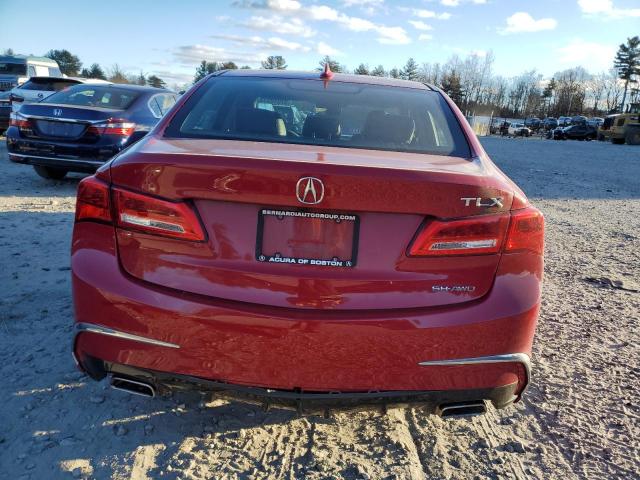 19UUB3F55JA001481 Acura TLX TECH