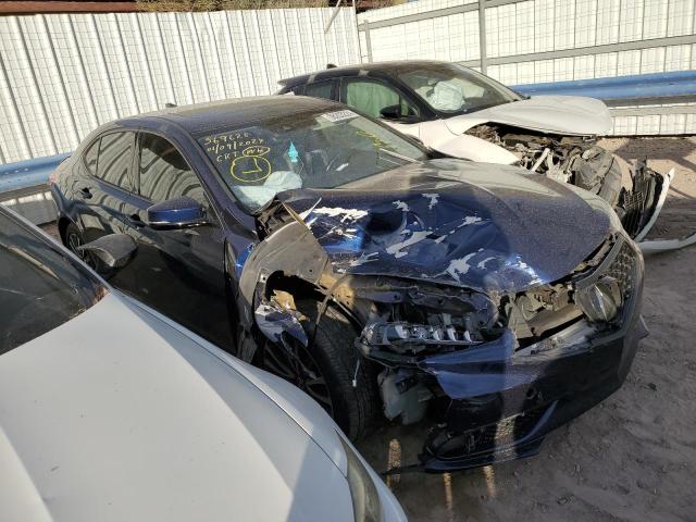 19UUB2F7XJA000404 Acura Tlx Advance