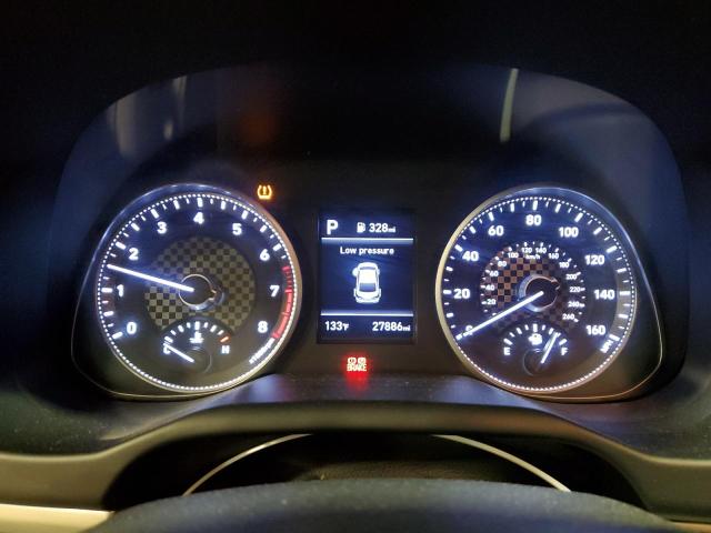 KMHD74LF3LU987450 Hyundai ELANTRA SE