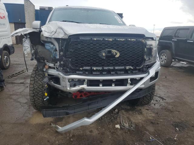 1FTEW1EP6JFE09294 Ford F150 Supercrew