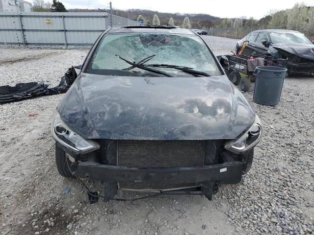 KMHD84LF9HU384877 Hyundai ELANTRA SE
