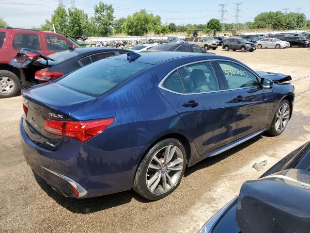 19UUB3F47KA005928 Acura Tlx Technology