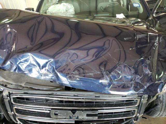 1GKS2AKCXJR201633 GMC YUKON SLE