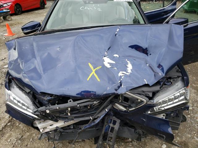19UUB1F58GA006199 Acura TLX TECH