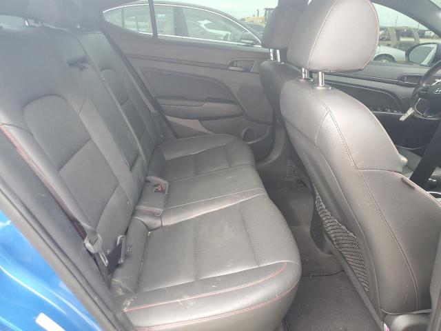 KMHD04LB5JU657775 Hyundai ELANTRA SP