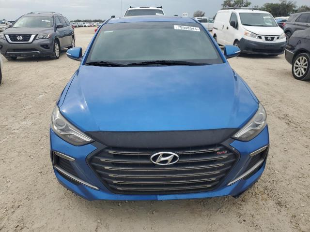 KMHD04LB5JU657775 Hyundai ELANTRA SP